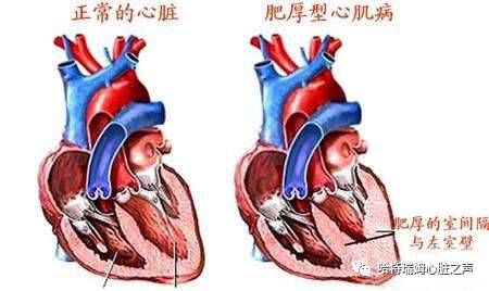房颤术后还"难受",解释在这里.